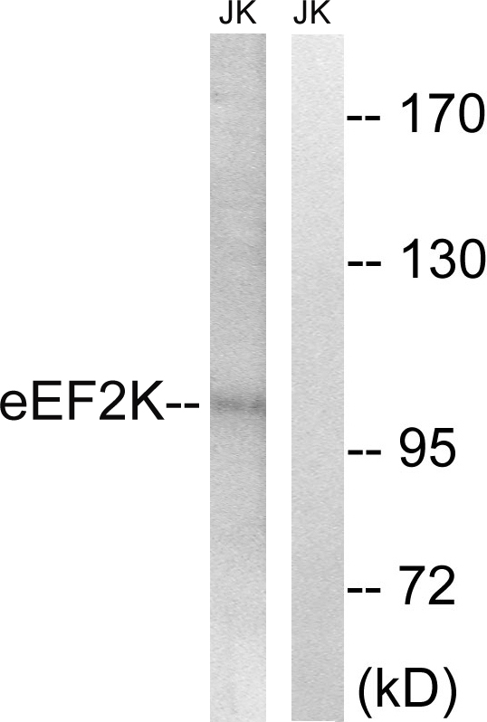 EEF2K Antibody - Western blot analysis of lysates from Jurkat cells, using eEF2K Antibody. The lane on the right is blocked with the synthesized peptide.