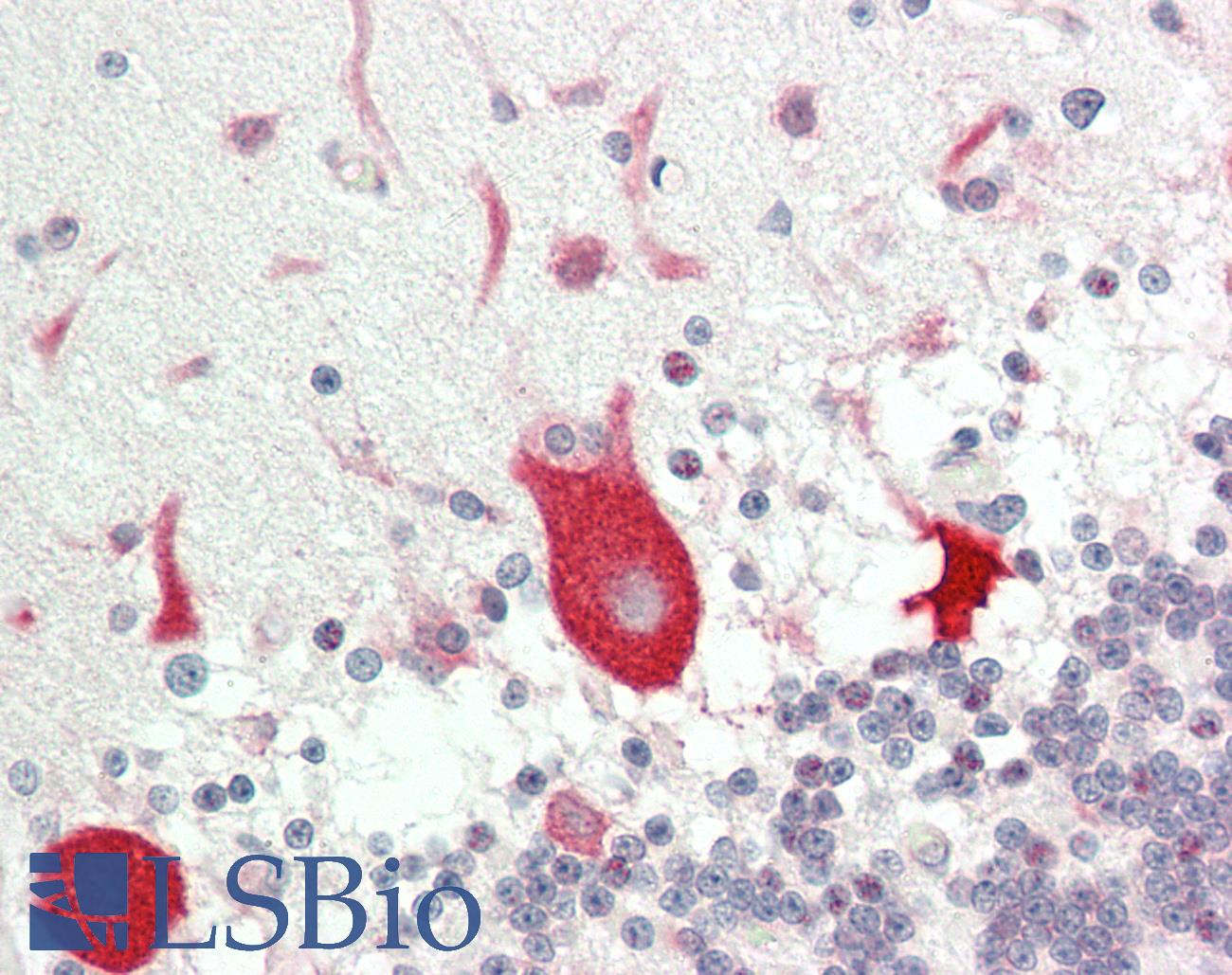 EF1G / EEF1G Antibody - Human Brain, Cerebellum: Formalin-Fixed, Paraffin-Embedded (FFPE)
