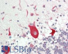 EF1G / EEF1G Antibody - Human Brain, Cerebellum: Formalin-Fixed, Paraffin-Embedded (FFPE)