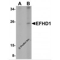 EFHD1 Antibody - Western blot analysis of EFHD1 in human spleen tissue lysate with EFHD1 antibody at (A) 2 and (B) 4 µg/mL.