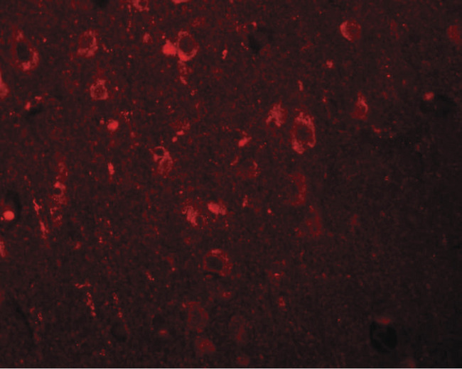 EFHD2 Antibody - Immunofluorescence of EFHD2 in human brain tissue with EFHD2 antibody at 20 ug/ml.