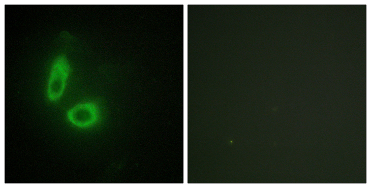 EFNA1 / Ephrin A1 Antibody - Immunofluorescence analysis of HeLa cells, using EFNA1 Antibody. The picture on the right is blocked with the synthesized peptide.