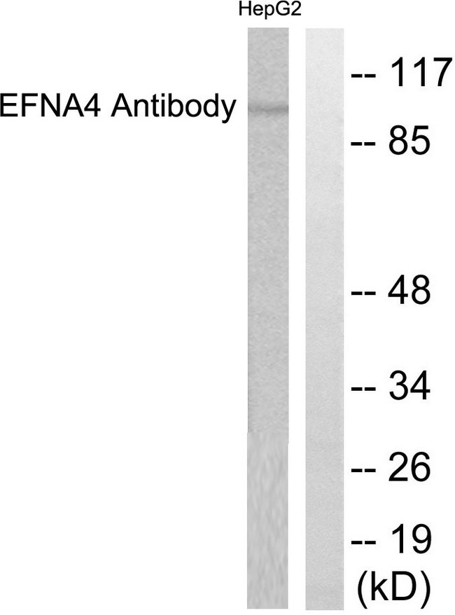 EFNA4 / Ephrin A4 Antibody - Western blot analysis of lysates from HepG2 cells, using EFNA4 Antibody. The lane on the right is blocked with the synthesized peptide.