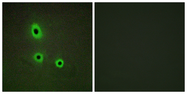 EFNA5 / Ephrin A5 Antibody - Immunofluorescence analysis of A549 cells, using EFNA5 Antibody. The picture on the right is blocked with the synthesized peptide.