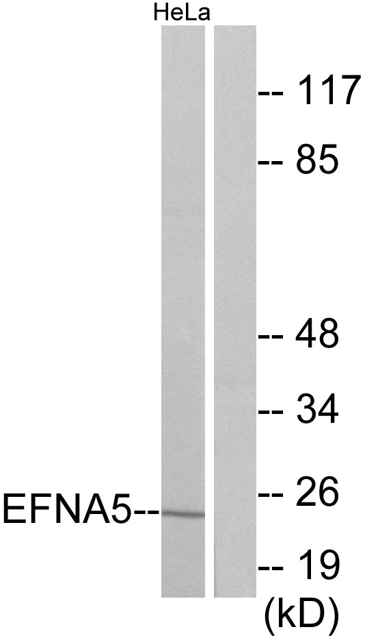 EFNA5 / Ephrin A5 Antibody - Western blot analysis of lysates from HeLa cells, using EFNA5 Antibody. The lane on the right is blocked with the synthesized peptide.