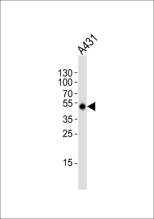 EFTU / TUFM Antibody - Western blot of lysate from A431 cell line with TUFM Antibody. Antibody was diluted at 1:1000. A goat anti-rabbit IgG H&L (HRP) at 1:10000 dilution was used as the secondary antibody. Lysate at 20 ug.
