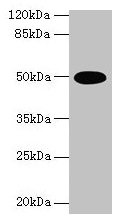 EFTU / TUFM Antibody - Western blot All lanes: Elongation factor Tu, mitochondrial antibody at 2µg/ml + U251 whole cell lysate Secondary Goat polyclonal to rabbit IgG at 1/10000 dilution Predicted band size: 50 kDa Observed band size: 50 kDa