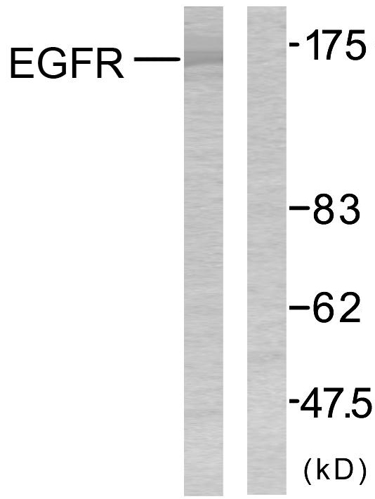 EGFR Antibody - Western blot analysis of lysates from SK-OV3 cells, using EGFR Antibody. The lane on the right is blocked with the synthesized peptide.