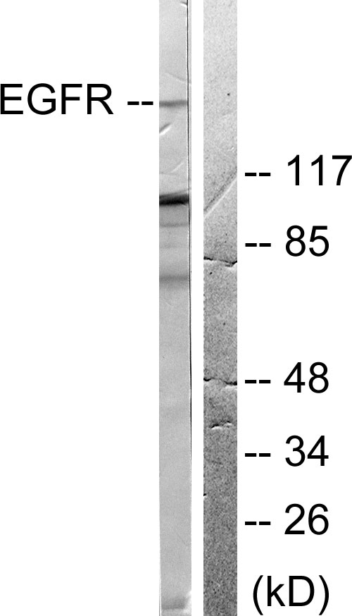 EGFR Antibody - Western blot analysis of lysates from 293 cells, treated with EGF 200ng/ml 30', using EGFR Antibody. The lane on the right is blocked with the synthesized peptide.