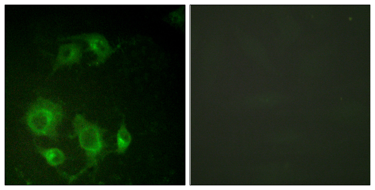 EGFR Antibody - Immunofluorescence analysis of HUVEC cells, using EGFR Antibody. The picture on the right is blocked with the synthesized peptide.