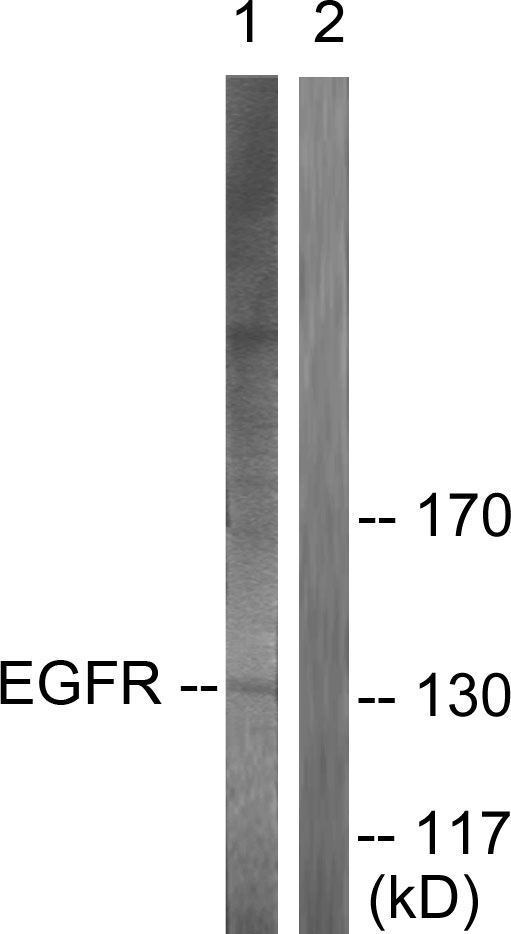 EGFR Antibody - Western blot analysis of lysates from A431 cells, using EGFR Antibody. The lane on the right is blocked with the synthesized peptide.