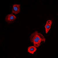 EGFR Antibody - Immunofluorescent analysis of EGFR staining in Jurkat cells. Formalin-fixed cells were permeabilized with 0.1% Triton X-100 in TBS for 5-10 minutes and blocked with 3% BSA-PBS for 30 minutes at room temperature. Cells were probed with the primary antibody in 3% BSA-PBS and incubated overnight at 4 deg C in a humidified chamber. Cells were washed with PBST and incubated with a DyLight 594-conjugated secondary antibody (red) in PBS at room temperature in the dark. DAPI was used to stain the cell nuclei (blue).