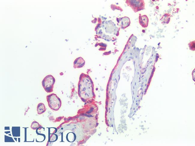 EGFR Antibody - Human Placenta: Formalin-Fixed, Paraffin-Embedded (FFPE)