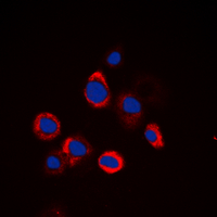 EGFR Antibody - Immunofluorescent analysis of EGFR staining in HeLa cells. Formalin-fixed cells were permeabilized with 0.1% Triton X-100 in TBS for 5-10 minutes and blocked with 3% BSA-PBS for 30 minutes at room temperature. Cells were probed with the primary antibody in 3% BSA-PBS and incubated overnight at 4 deg C in a humidified chamber. Cells were washed with PBST and incubated with a DyLight 594-conjugated secondary antibody (red) in PBS at room temperature in the dark. DAPI was used to stain the cell nuclei (blue).