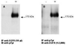 EGFR Antibody - Immunoprecipitation/Western Blot - Anti-EGFR Antibody. Combined immunoprecipitation and Western blot of anti-EGFR antibody. Lysates were prepared from GN4 rat liver epithelial cells both with (+) EGF treatment for 15 at 100 ng/ml and without (-) the addition of EGF. The combination of immunoprecipitation and western blotting was performed using the anti-EGFR antibody for immunoprecipitation (10 ul) followed by western blot detection using an anti-phosphotyrosine antibody (Panel A). This was repeated in reverse order using a 1:2000 dilution of anti-EGFR for western blot (Panel B). Visualization occurred using an ECL system. Film exposure was approximately 1. Other detection systems will yield similar results.