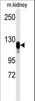 EGFR Antibody - Western blot of anti-EGFR Antibody (S1070) in kidney heart tissue lysates (35 ug/lane). EGFR(arrow) was detected using the purified antibody.
