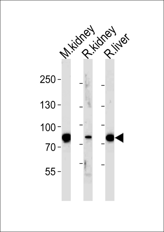 EHHADH / Enoyl-Coa Hydratase Antibody - Western blot of lysates from mouse kidney, rat kidney and liver tissue (from left to right), using EHHADH Antibody. Antibody was diluted at 1:1000 at each lane. A goat anti-rabbit IgG H&L (HRP) at 1:5000 dilution was used as the secondary antibody. Lysates at 35ug per lane.