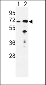EHHADH / Enoyl-Coa Hydratase Antibody - Western blot of EHHADH Antibody in mouse liver (lane 1), kidney(lane 2) tissue lysates (35 ug/lane). EHHADH (arrow) was detected using the purified antibody.