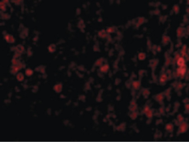 EIF2AK2 / PKR Antibody - Immunofluorescence of PKR in Rat Lung cells with PKR antibody at 20 ug/ml.