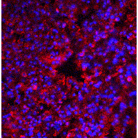 EIF2AK2 / PKR Antibody - Immunofluorescence of PKR in mouse lung tissue with PKR antibody at 20 µg/ml.Red: PKR Antibody  Blue: DAPI staining