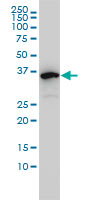 EIF2B2 Antibody - Western blot of EIF2B2 expression in K-562.
