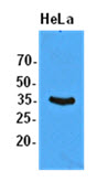 EIF2S1 Antibody - Extracts of HeLa (50 ug) were resolved by SDS-PAGE, transferred to PVDF membrane and probed with anti-human EIF2S1 (1:1000). Proteins were visualized using a goat anti-mouse secondary antibody conjugated to HRP and an ECL detection system.