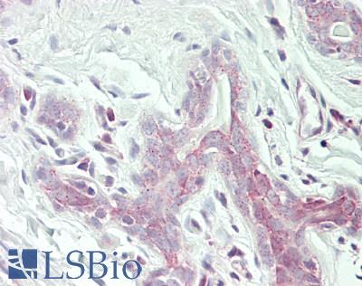 EIF2S2 Antibody - Human Breast: Formalin-Fixed, Paraffin-Embedded (FFPE)