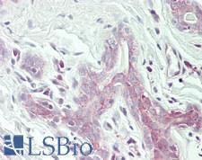 EIF2S2 Antibody - Human Breast: Formalin-Fixed, Paraffin-Embedded (FFPE)