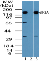 EIF3A Antibody - Western blot of eIF3A in Daudi cell lysate in the 1) absence and 2) presence of immunizing peptide and 3) NIH 3T3 cell lysate using EIF3A Antibody at 0.5 ug/ml, 0.5 ug/ml and 0.25 ug/ml respectively.
