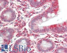EIF3B Antibody - Human Small Intestine: Formalin-Fixed, Paraffin-Embedded (FFPE)