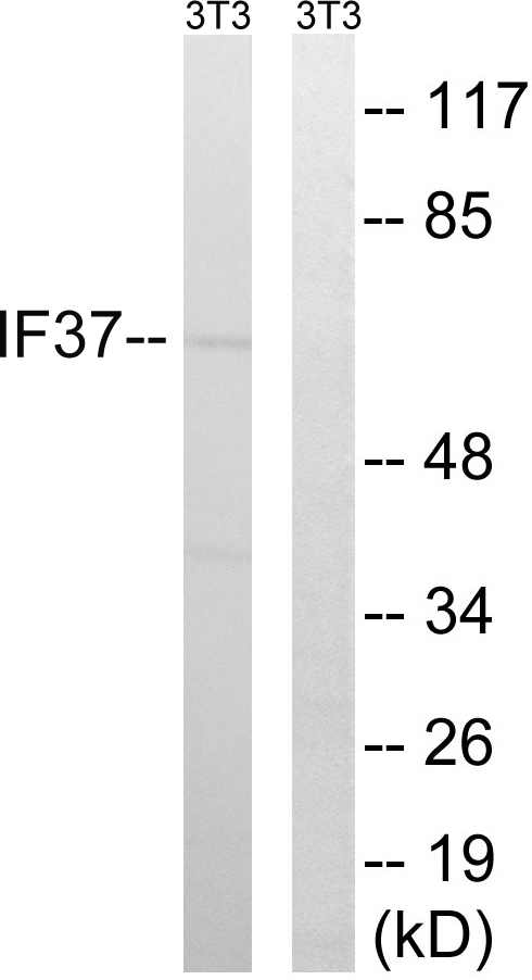 EIF3D Antibody - Western blot analysis of lysates from NIH/3T3 cells, using EIF3D Antibody. The lane on the right is blocked with the synthesized peptide.