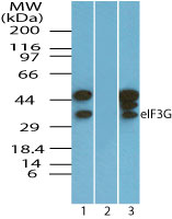 EIF3G Antibody - Western blot of eIF3G in Ramos cell lysate in the 1) absence and 2) presence of immunizing peptide and 3) RAW cell lysate using EIF3G Antibody at 0.025 ug/ml. Goat anti-rabbit Ig HRP secondary antibody, and PicoTect ECL substrate solution, were used for this test.