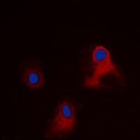 EIF3L / EIF3EIP Antibody - Immunofluorescent analysis of EIF3L staining in HEK293 cells. Formalin-fixed cells were permeabilized with 0.1% Triton X-100 in TBS for 5-10 minutes and blocked with 3% BSA-PBS for 30 minutes at room temperature. Cells were probed with the primary antibody in 3% BSA-PBS and incubated overnight at 4 deg C in a humidified chamber. Cells were washed with PBST and incubated with a DyLight 594-conjugated secondary antibody (red) in PBS at room temperature in the dark. DAPI was used to stain the cell nuclei (blue).