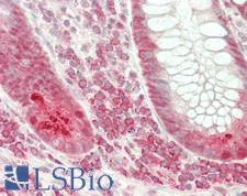 EIF4A1 Antibody - Human Small Intestine: Formalin-Fixed, Paraffin-Embedded (FFPE)