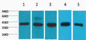 EIF4A1 Antibody - Western Blot (WB) analysis of 1) 293T, 2) HeLa, 3) HepG2, 4) Mouse Brain tissue.