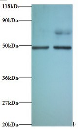 EIF4A2 Antibody - Western blot of Eukaryotic initiation factor 4A-II antibody at 2 ug/ml. Lane 1: EC109 whole cell lysate. Lane 2: 293T whole cell lysate. Secondary: Goat polyclonal to Rabbit IgG at 1:15000 dilution. Predicted band size: 44.8 kDa. Observed band size: 44.8 kDa Additional bands at: 70 kDa. We are unsure as to the identity of these extra band.  This image was taken for the unconjugated form of this product. Other forms have not been tested.