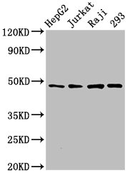 EIF4A2 Antibody - Western Blot Positive WB detected in: HepG2 whole cell lysate, Jurkat whole cell lysate, Raji whole cell lysate, 293 whole cell lysate All lanes: EIF4A2 antibody at 3µg/ml Secondary Goat polyclonal to rabbit IgG at 1/50000 dilution Predicted band size: 47 kDa Observed band size: 47 kDa