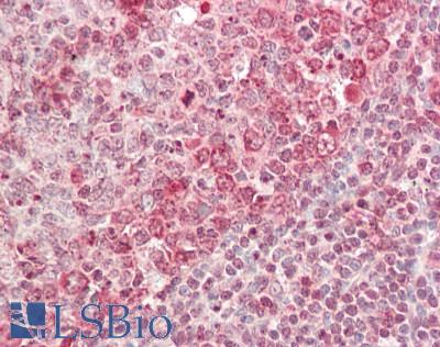 EIF4A2 Antibody - Human Tonsil: Formalin-Fixed, Paraffin-Embedded (FFPE).  This image was taken for the unconjugated form of this product. Other forms have not been tested.