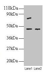 EIF4A2 Antibody - Western blot All lanes: Eukaryotic initiation factor 4A-II antibody at 2/ml Lane 1: EC109 whole cell lysate Lane 2: 293T whole cell lysate Secondary Goat polyclonal to rabbit IgG at 1/10000 dilution Predicted band size: 44.5 kDa Observed band size: 44.5 kDa