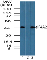 EIF4A2 Antibody - Western blot of eIF4A2 in Jurkat cell lysate in the 1) absence, 2) presence of immunizing peptide and 3) 3T3 cell lysate using EIF4A2 Antibody at 0.05 ug/ml, 0.05 ug/ml and 0.025 ug/ml, respectively.