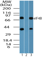 EIF4B Antibody - Western blot of eIF4B in HeLa cell lysate in the 1) absence, 2) presence of immunizing peptide and 3) RAW using EIF4B Antibody at 0.25 ug/ml.
