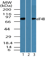 EIF4B Antibody - Western blot of eIF4B in K562 cell lysate in the 1) absence and 2) presence of immunizing peptide, and 3) RAW cell lysate using EIF4B Antibody at 0.005 ug/ml, 0.005 ug/ml and 1.0 ug/ml respectively.