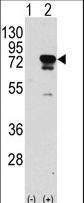 EIF4B Antibody - Western blot of EIF4B (arrow) using rabbit polyclonal EIF4B Antibody (S422) (RB13724). 293 cell lysates (2 ug/lane) either nontransfected (Lane 1) or transiently transfected with the EIF4B gene (Lane 2) (Origene Technologies).