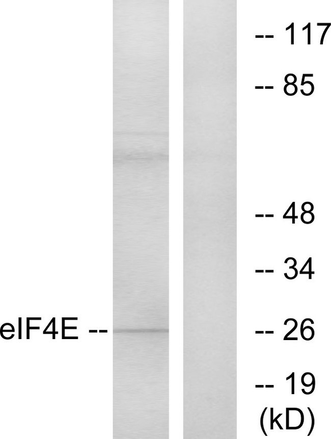 EIF4E Antibody - Western blot analysis of lysates from NIH/3T3 cells, treated with FBS, using eIF4E Antibody. The lane on the right is blocked with the synthesized peptide.