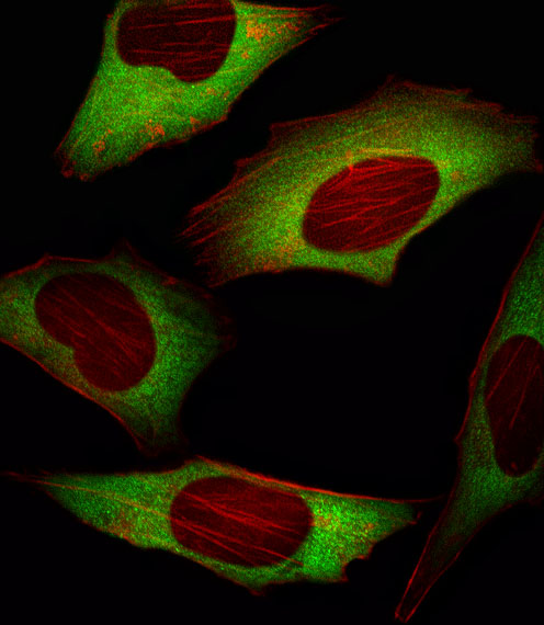 EIF4E Antibody - Fluorescent image of HeLa cell stained with EIF4E Antibody. HeLa cells were fixed with 4% PFA (20 min), permeabilized with Triton X-100 (0.1%, 10 min), then incubated with EIF4E primary antibody (1:25, 1 h at 37°C). For secondary antibody, Alexa Fluor 488 conjugated donkey anti-mouse antibody (green) was used (1:400, 50 min at 37°C). Cytoplasmic actin was counterstained with Alexa Fluor 555 (red) conjugated Phalloidin (7units/ml, 1 h at 37°C). EIF4E immunoreactivity is localized to Cytoplasm significantly.