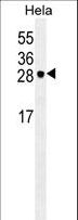 EIF4E Antibody - EIF4E Antibody western blot of HeLa cell line lysates (35 ug/lane). The EIF4E antibody detected the EIF4E protein (arrow).