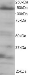 EIF4ENIF1 / 4E-T Antibody - Antibody staining (0.25 ug/ml) of 293 lysate (RIPA buffer, 35 ug total protein per lane). Primary incubated for 1 hour. Detected by Western blot of chemiluminescence.