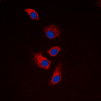 EIF4G1 / EIF4G Antibody - Immunofluorescent analysis of EIF4G1 staining in HEK293T cells. Formalin-fixed cells were permeabilized with 0.1% Triton X-100 in TBS for 5-10 minutes and blocked with 3% BSA-PBS for 30 minutes at room temperature. Cells were probed with the primary antibody in 3% BSA-PBS and incubated overnight at 4 ??C in a humidified chamber. Cells were washed with PBST and incubated with a DyLight 594-conjugated secondary antibody (red) in PBS at room temperature in the dark. DAPI was used to stain the cell nuclei (blue).