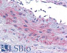 EIF5A Antibody - Anti-EIF5A antibody IHC of human vessel. Immunohistochemistry of formalin-fixed, paraffin-embedded tissue after heat-induced antigen retrieval. Antibody concentration 3.75 ug/ml.