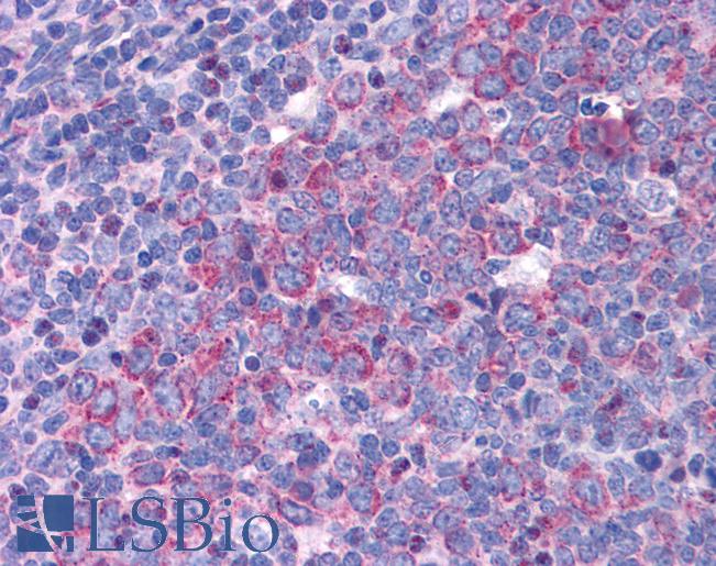 EIF5A Antibody - Anti-EIF5A antibody IHC of human tonsil. Immunohistochemistry of formalin-fixed, paraffin-embedded tissue after heat-induced antigen retrieval. Antibody concentration 3.75 ug/ml.